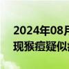 2024年08月21日快讯 阿根廷境内一货船发现猴痘疑似病例